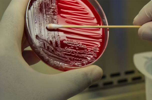 Lab Test